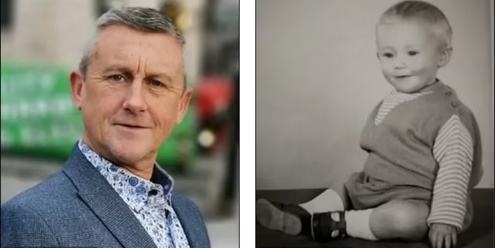 Tragedia unui britanic: injectat în copilărie cu hormoni de la cadavre, riscă să sufere de Alzheimer şi o altă boală ce-l poate ucide într-un an VIDEO