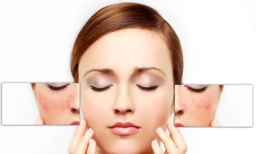 2 71352 original jpg jpeg