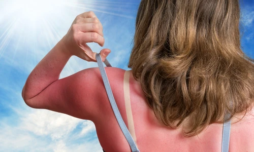 1 arsura solara jpg jpeg