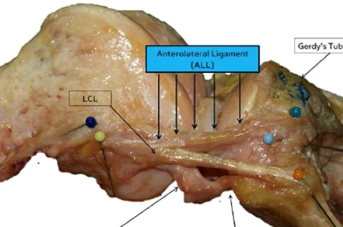 Ligament anterolateral la genunchi nou descoperit FOTO Spitalul Universitar Leuven