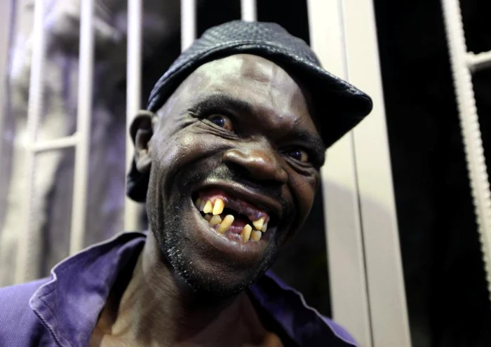 Mison Sere, în vârstă de 42 de ani, a fost încoronat, sâmbătă seară, în Harare, Mr. Ugly 2015. Juriul a "apreciat" numeroşii dinţi lipsă şi expresiile sale faciale groteşti. FOTO sandiegouniontribune.com