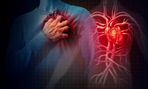 imagine insuficienta cardiaca jpg