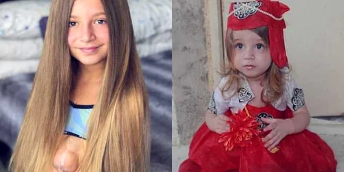 fetita cu inima in afara pieptului