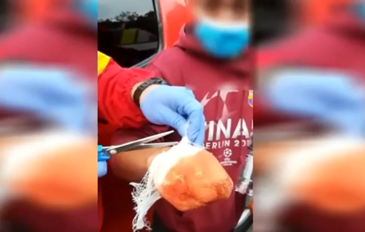 Paramedicii îi taie bandajele false și se dovedește că cerșetorul avea mâinifoto: captură Adevarul.ro