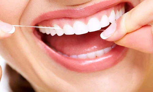 1 77154 original jpg jpeg