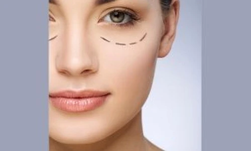 1 73265 original jpg jpeg