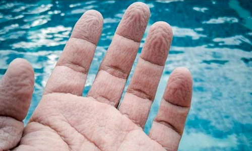 degete incretite dupa ce au stat in apa foto X