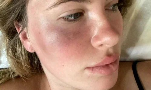 1 ireland 1 jpg jpeg