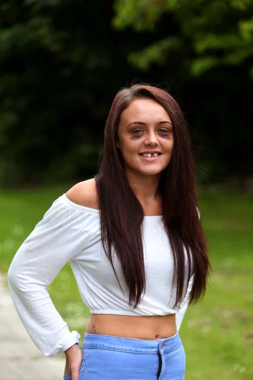 Bărbatul i-a rupt câteva coaste şi nasul, i-a învineţit ochii şi i-a dat un dinte jos