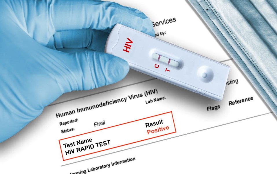Previziuni sumbre. Numărul infectărilor cu HIV ar putea ajunge la 2.000 de cazuri zilnic, din cauza deciziilor luate de Trump