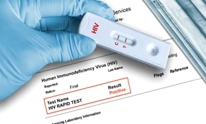 HIV jpg