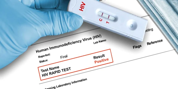 HIV jpg