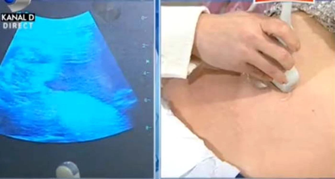 
    Roxana a aflat sexul copilului, în directFoto: Captură Kanal D  