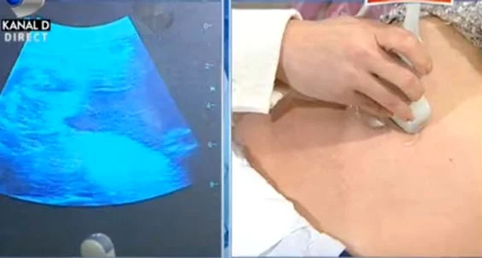 Roxana a aflat sexul copilului, în directFoto: Captură Kanal D