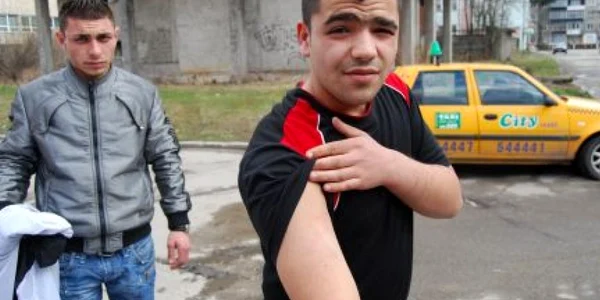 Lucian Sorean (centru) arată semnele agresiuniii. Foto: M. Gânju