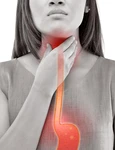1 reflux gastroesofagian jpg jpeg
