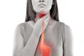 1 reflux gastroesofagian jpg jpeg