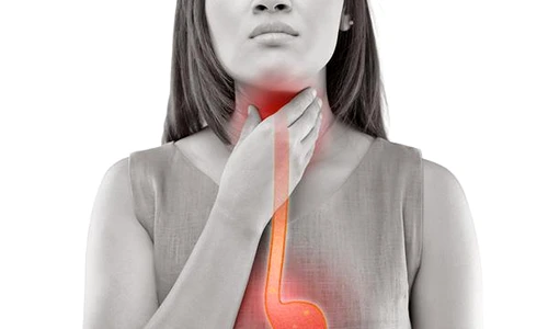 1 reflux gastroesofagian jpg jpeg