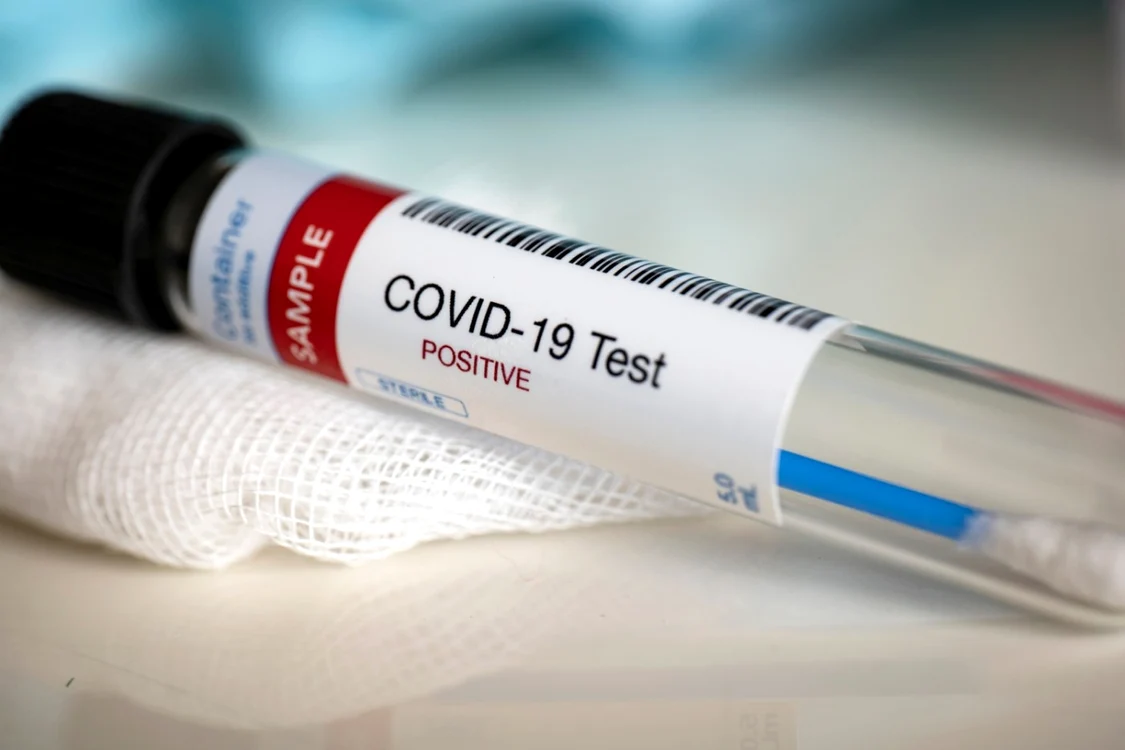 Test covid - coronavirus / FOTO Shutterstock