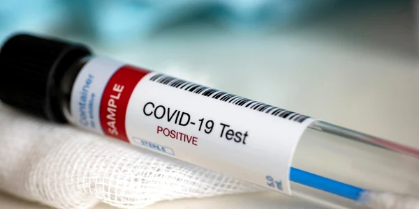 Test covid - coronavirus / FOTO Shutterstock