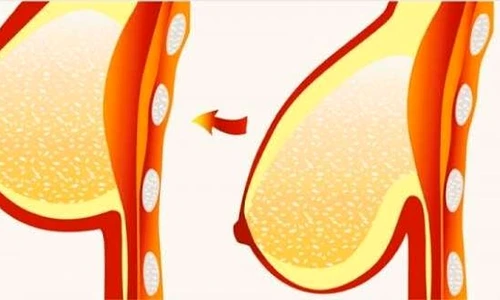 1 74874 original jpg jpeg