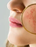rozaceea ten shutterstock 1895847337 jpg