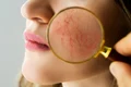 rozaceea   ten   shutterstock 1895847337 jpg