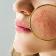 rozaceea   ten   shutterstock 1895847337 jpg