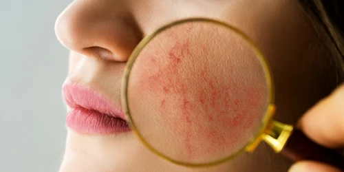 rozaceea   ten   shutterstock 1895847337 jpg