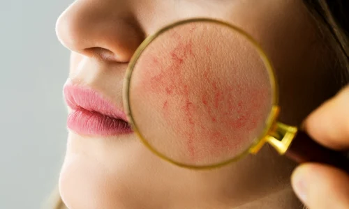 rozaceea   ten   shutterstock 1895847337 jpg