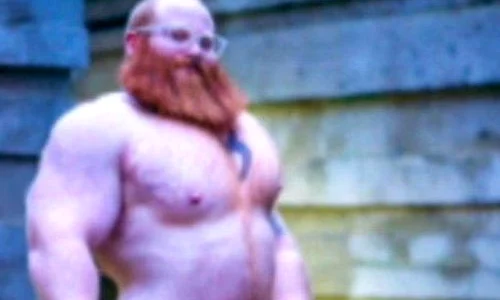 Jack Chapman, în vârstă de 28 de ani, a vrut să aibă cele mai mari testicule din lume jpeg