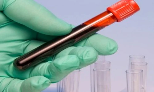 1 79227 original jpg jpeg