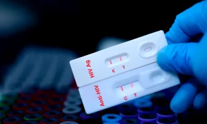 test HIV jpg