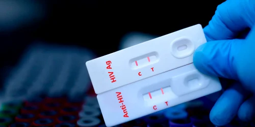 test HIV jpg