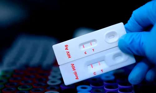 test HIV jpg