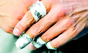 Aşa arată mâna lui Rafa! jpeg