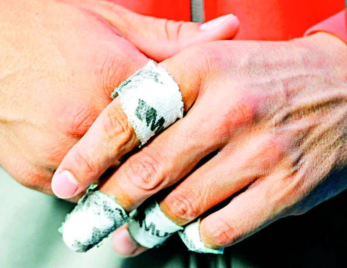 Aşa arată mâna lui Rafa!