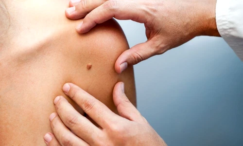 1 73815 original jpg jpeg