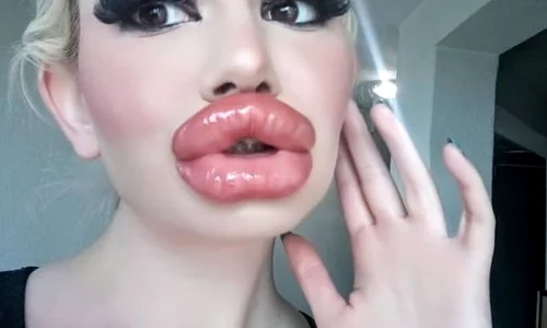 13 femeia cu cele mai mari buze din lume 2 jpg jpeg