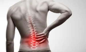 durere de spate