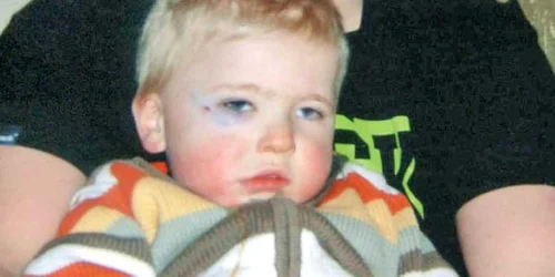 Josh, în braţele tatălui său, Mark, după ce şi-a învineţit ochiul