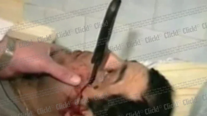 Bărbatul a supravieţuit chiar dacă s-a ales cu un cuţit în faţă