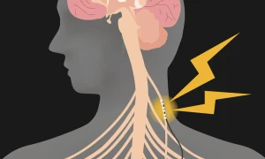 nervul vag foto Healthy women webp