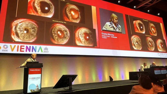 ce inseamna cea mai buna clinica oftalmologica din romania performan a i experien a de top oculus de 30 de ani lider in chirurgia oftalmologica51 jpg