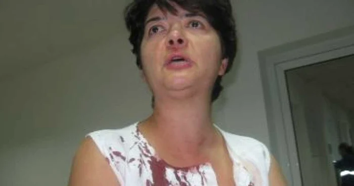 Timişoara: VIDEO Avocata bătută de romi în centrul oraşului: „Ţiganii m-au ameninţat de faţă cu poliţia că îmi iau gâtul”