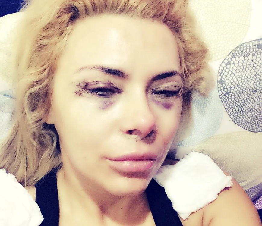 
    Jasmine, pe mâinile medicului Ion Zegreafoto: arhiva personală  