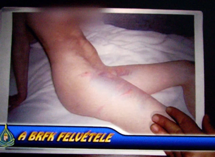 Tânără maltratată în urma filmărilor sado-masochiste (foto: blikk.hu)