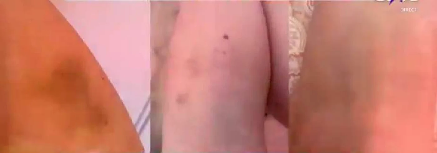 Tânără s-ar fi ales cu mai multe vânătăi după ce ar fi fost bătută de Bianca 
