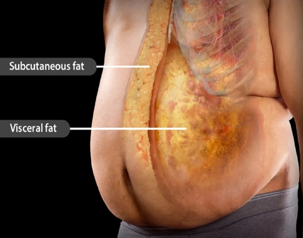 Cum atacă grăsimea viscerală „ascunsă” organele interne: videoclipul viral care șochează internetul. Pericol și pentru persoanele slabe