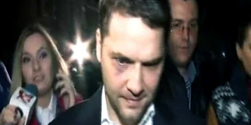 Sova vanat la ochi FOTO Captura DIGI24